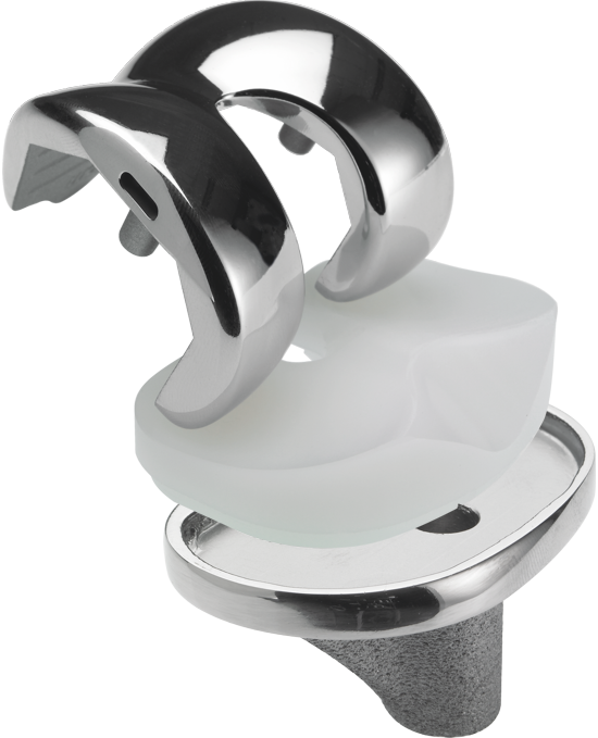 GKS PRIME FLEX 高屈曲膝關節假體