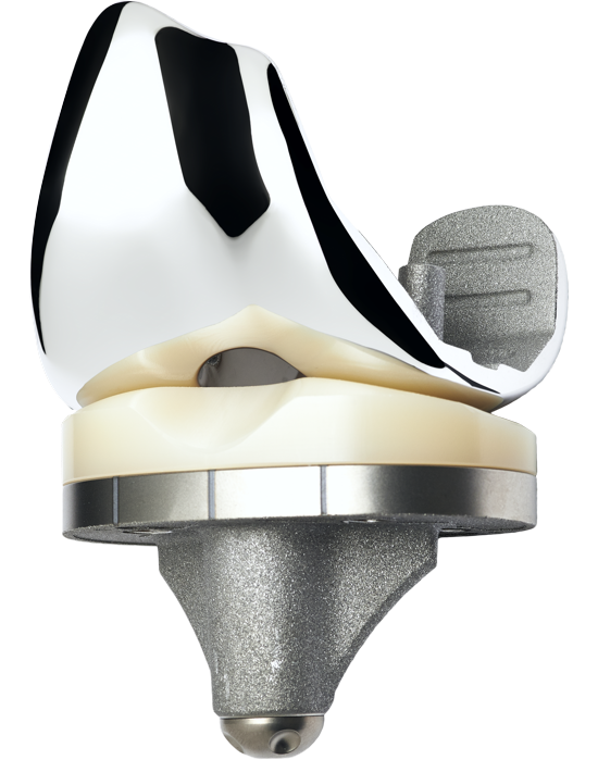 GKS PRIME FLEX 高屈曲膝關節假體